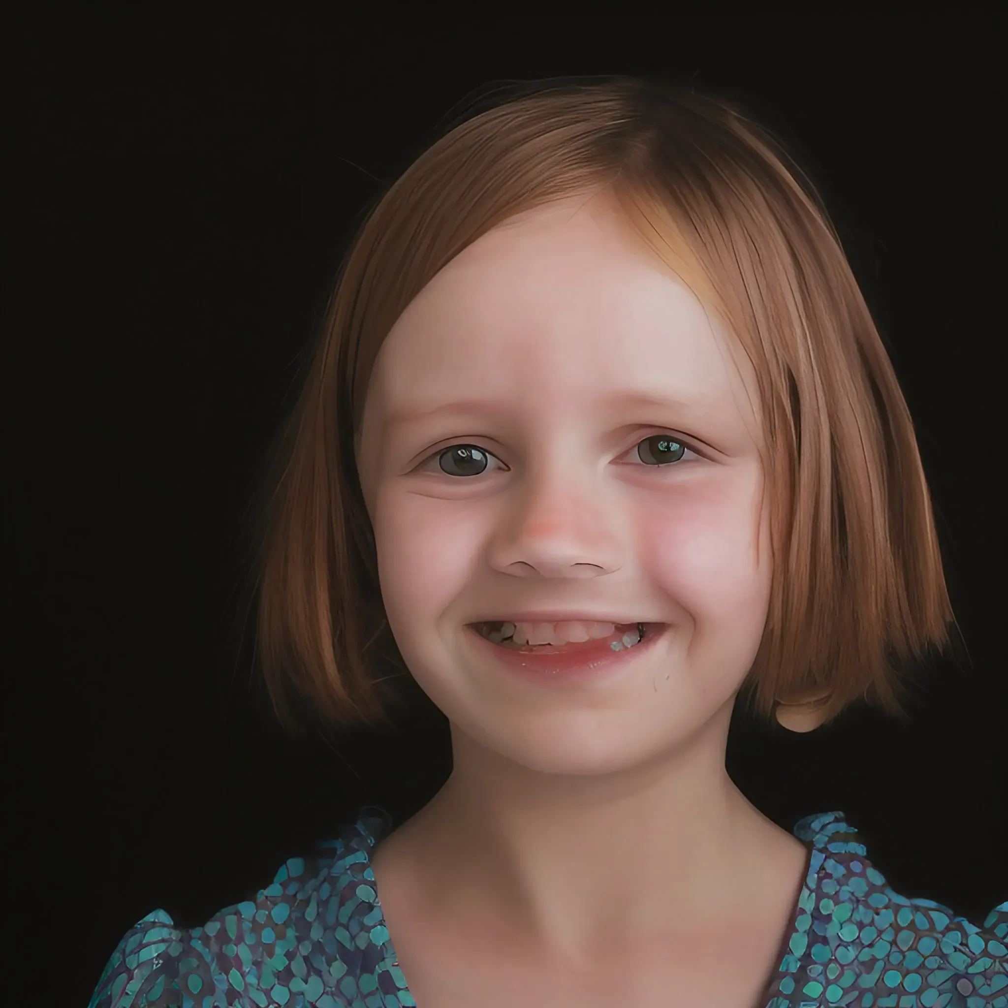 Fetal Alcohol Syndrome Disorder Picture Of Young Female Child